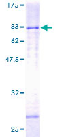 12.5% SDS-PAGE Stained with Coomassie Blue.